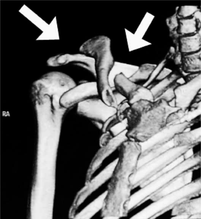 Figure 3c