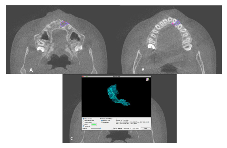 Figure 2