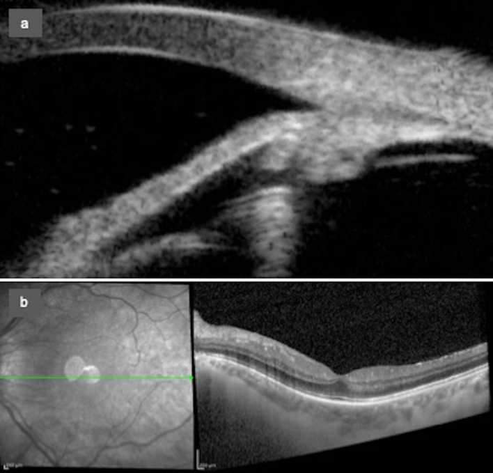 Fig. 6