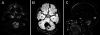 FIG. 1.
