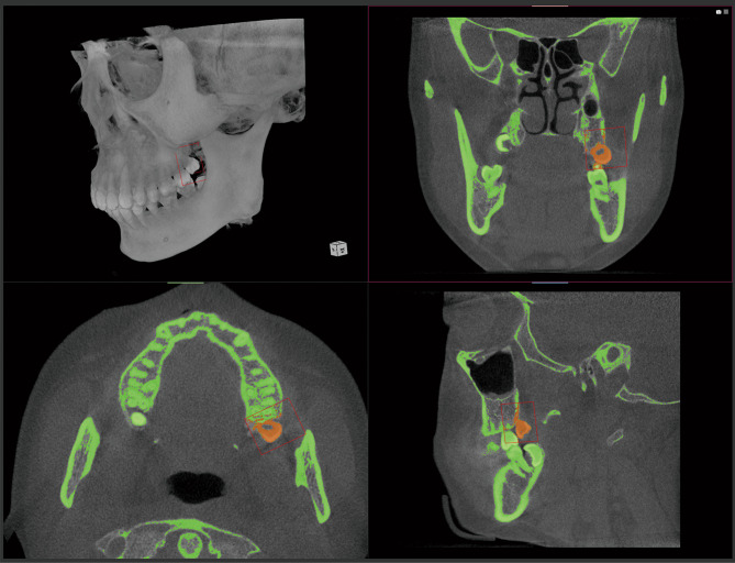 Fig. 5