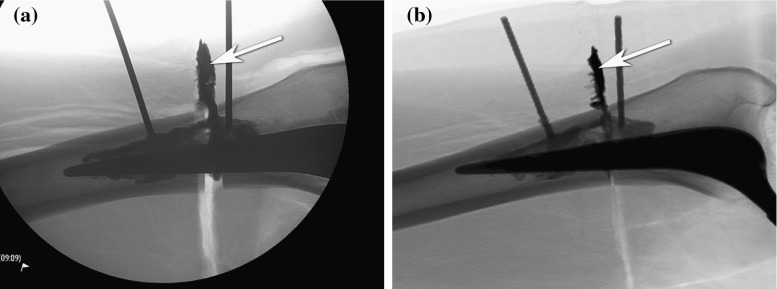 Fig. 16