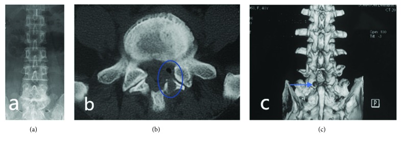 Figure 4