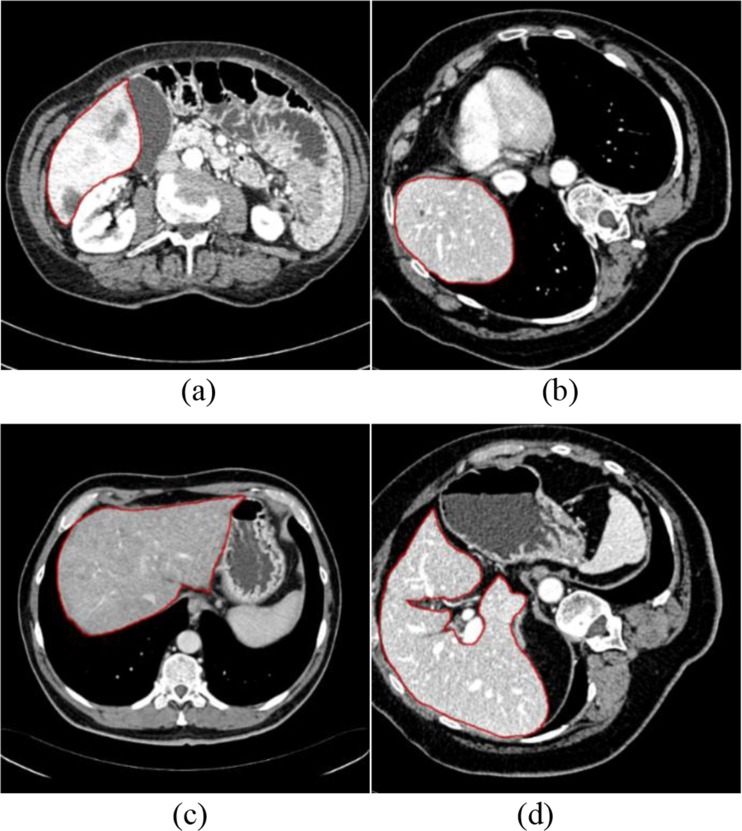 Fig. 12