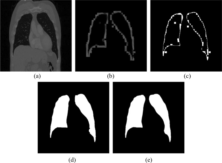 Fig. 11