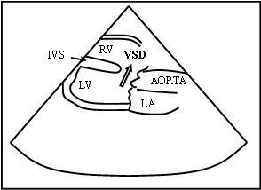 [Table/Fig-1b]: