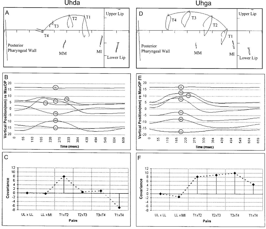 FIG. 1