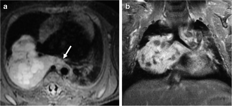 Fig. 11