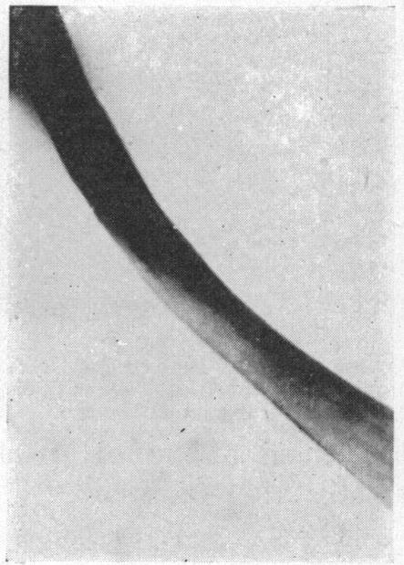 FIG. 8c.