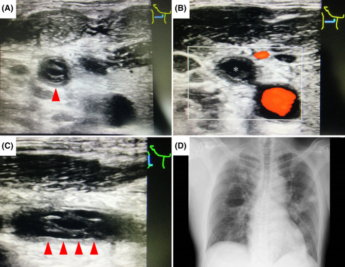 FIGURE 1