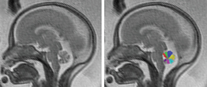 UOG-21890-FIG-0002-c