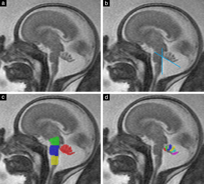 UOG-21890-FIG-0001-c