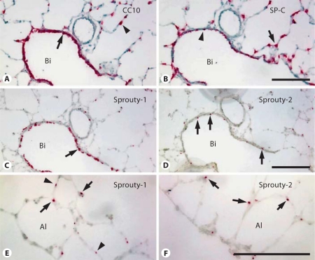 Fig. 11