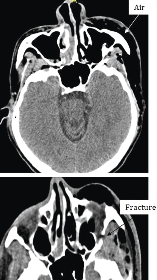 Figure 1: