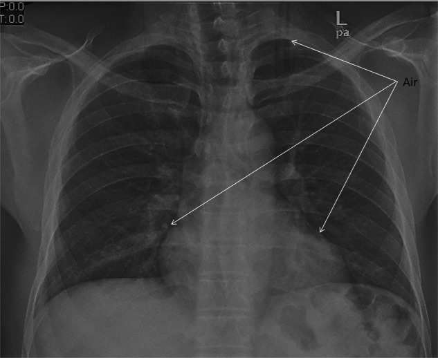 Figure 2: