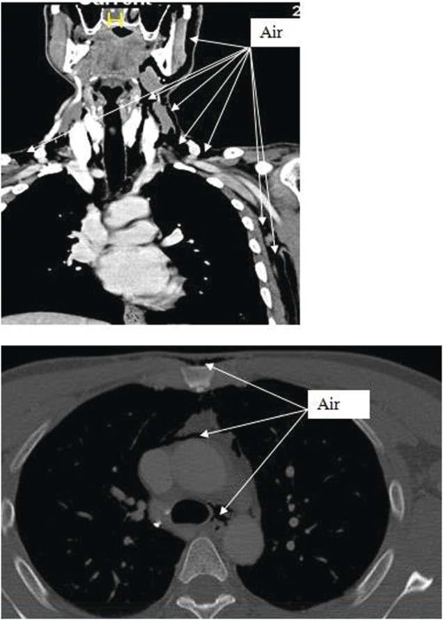 Figure 3: