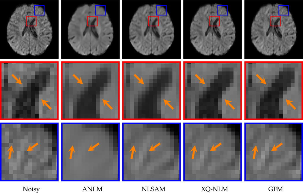 Fig. 13: