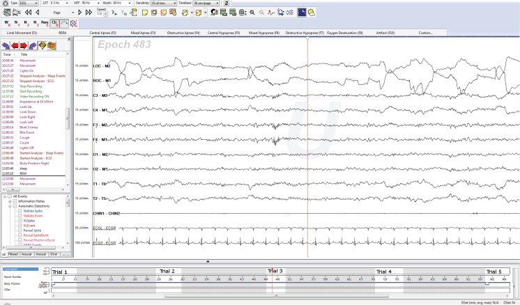 Figure 3: