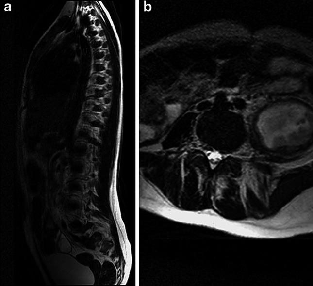 Fig. 1