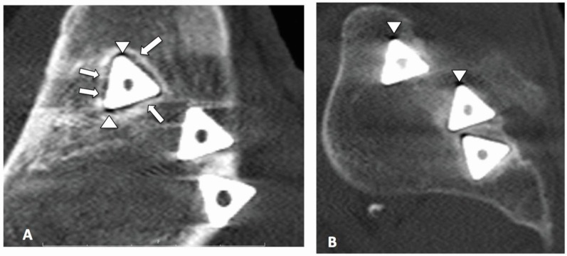 Fig. (6)