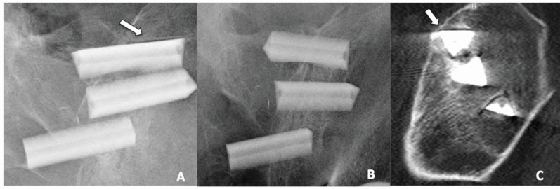 Fig. (4)