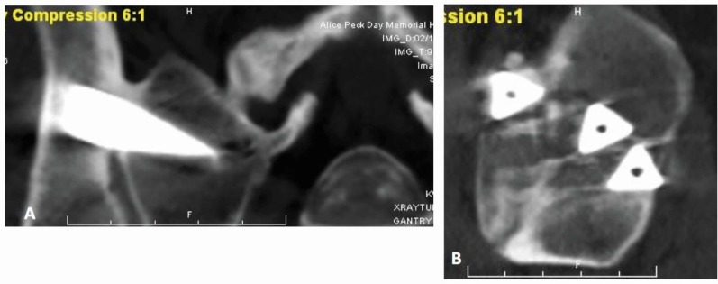 Fig. (3)