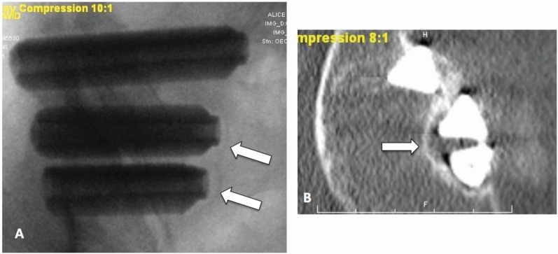 Fig. (7)