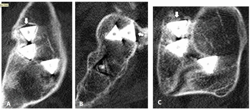 Fig. (5)