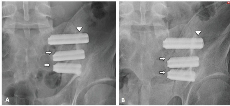 Fig. (2)