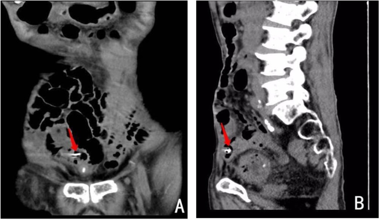 Fig. 1
