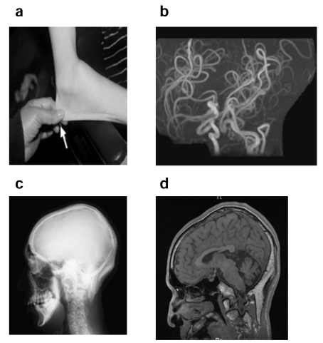 Fig. (9)