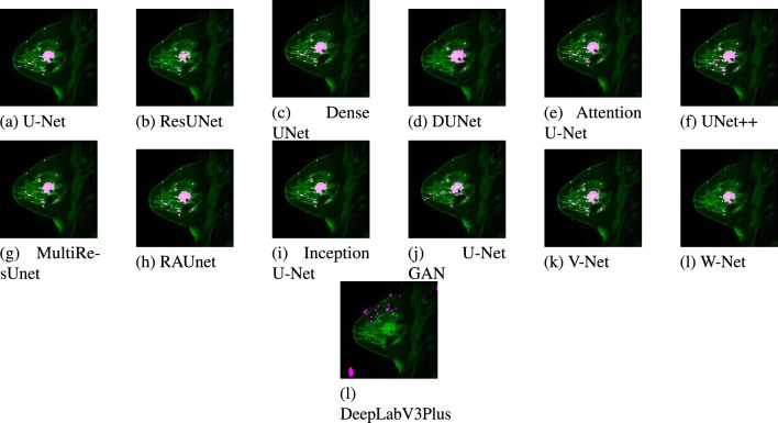 Figure 13