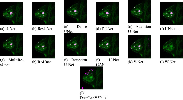 Figure 14