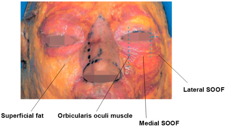 Figure 19