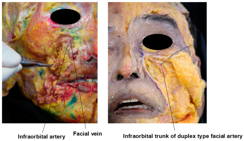 Figure 23