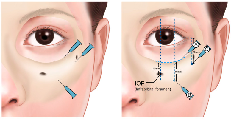 Figure 21