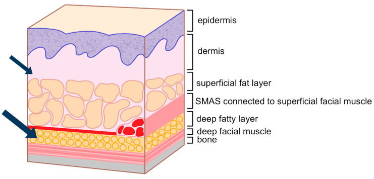 Figure 20