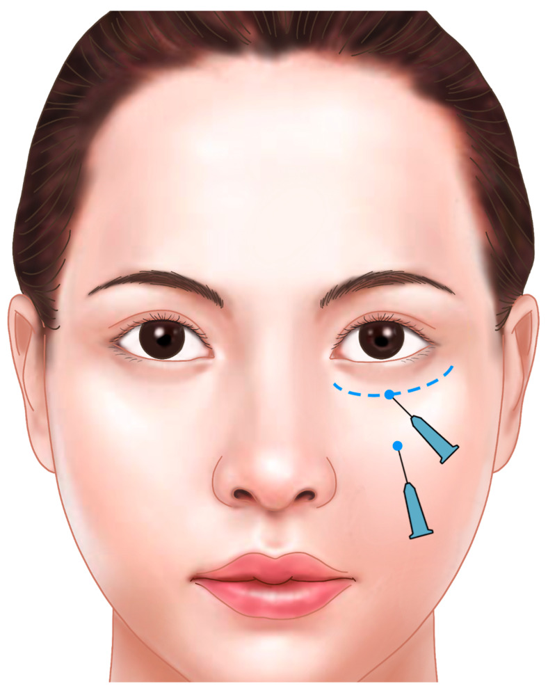 Figure 22