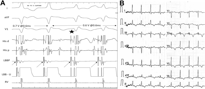 Figure 3