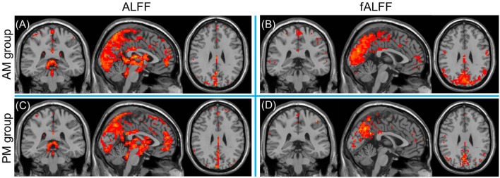 FIGURE 3