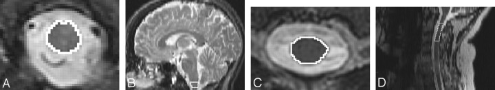 Fig 1.