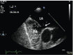 Fig. (4)