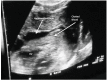 Fig. (3)