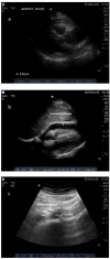 Fig. (2)