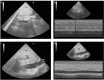 Fig. (1)
