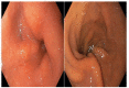 Figure 4 -