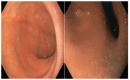 Figure 2 -