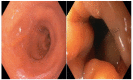 Figure 3 -
