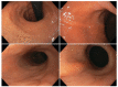 Figure 1 -