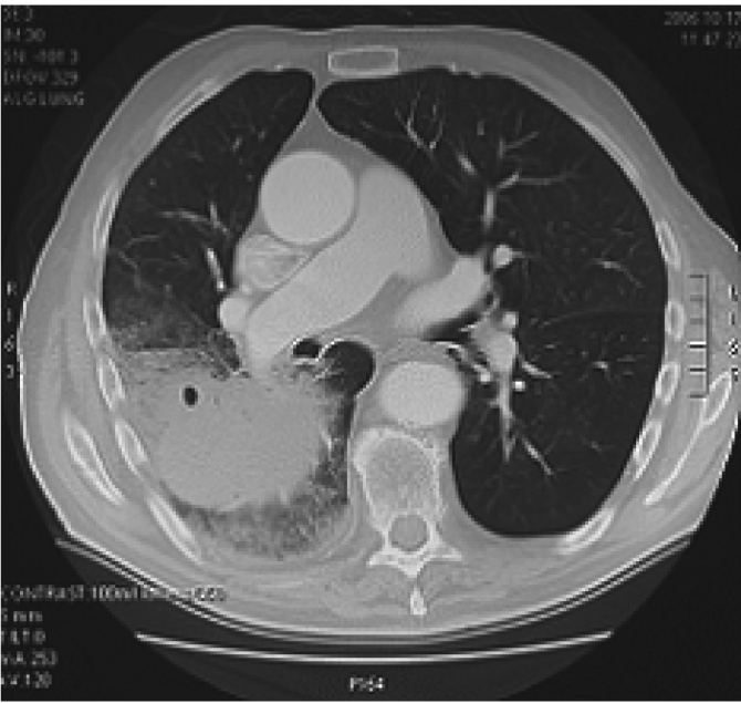 Fig 2.